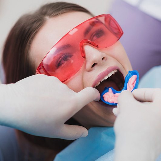 Woman in protective glasses opening mouth so fluoride tray can be placed over teeth