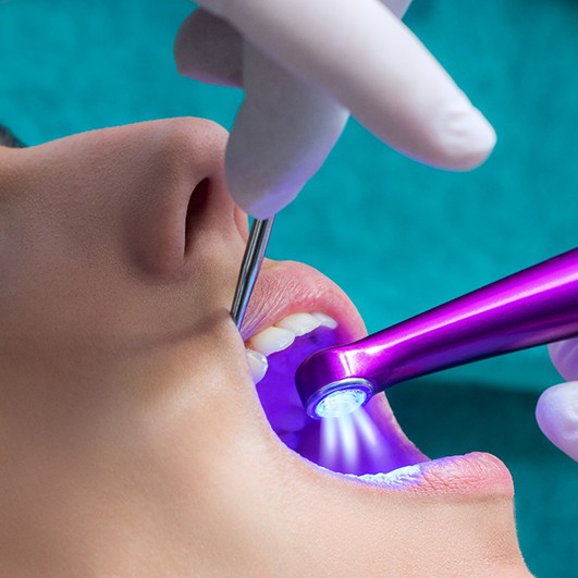 Teen getting dental sealants