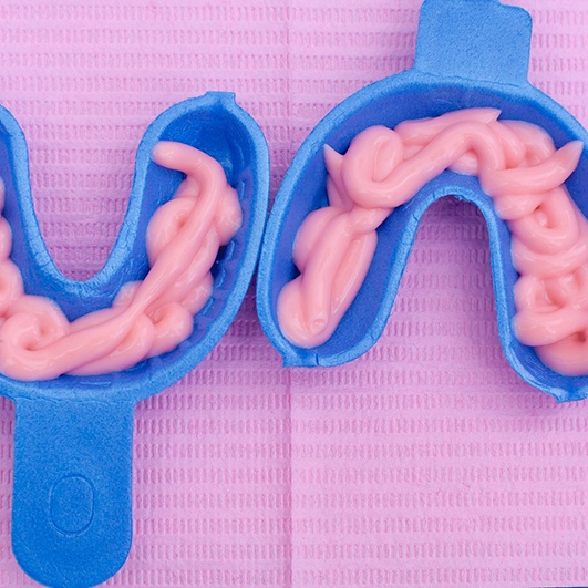 Fluoride treatment