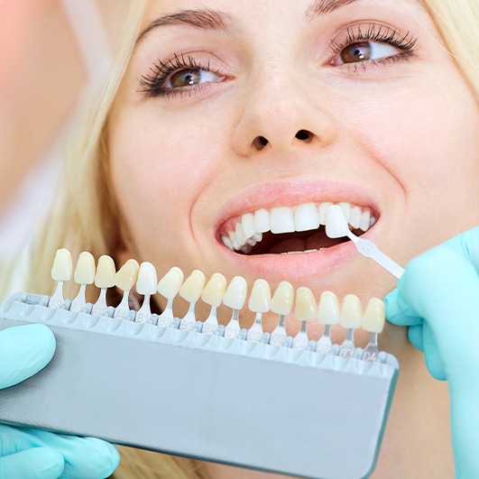 Woman's smile compared with porcelain veneers shade chart during cosmetic dentistry consultation