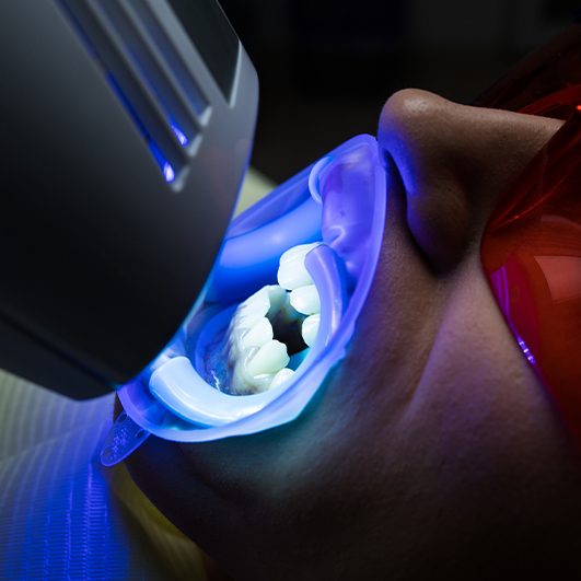 Patient receiving professional teeth whitening treatment