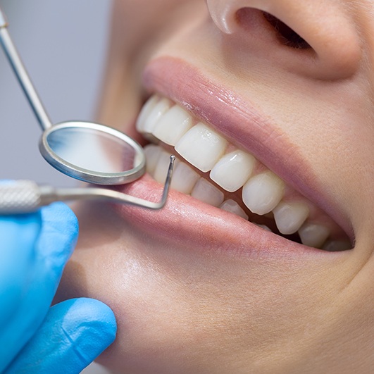 Patient's smile after gum recontouring treatment