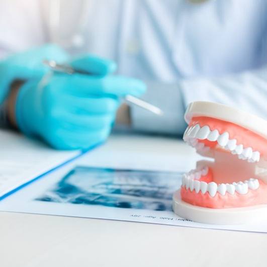 a pair of plastic teeth on the dentists desk