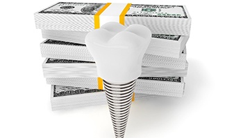 Dental implant next to a stack of money
