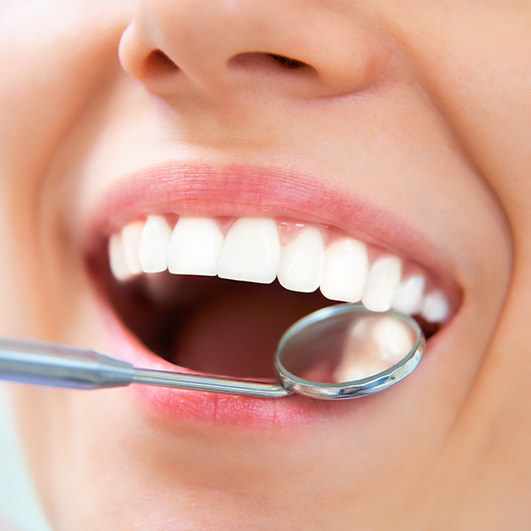 Dentist examining patient's smile after tooth colored filling treatment