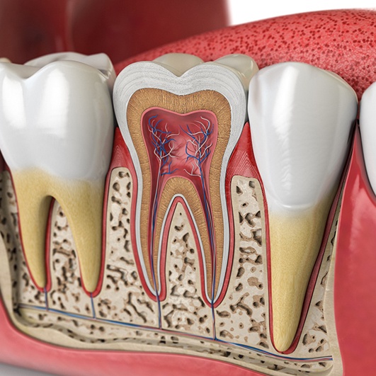 illustration of root canal therapy in Eatontown