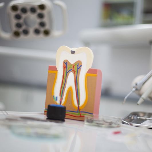 Model of the inside of a tooth before root canal therapy
