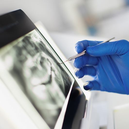 Digital x-rays on tablet computer