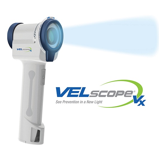 Velscope oral cancer screening device