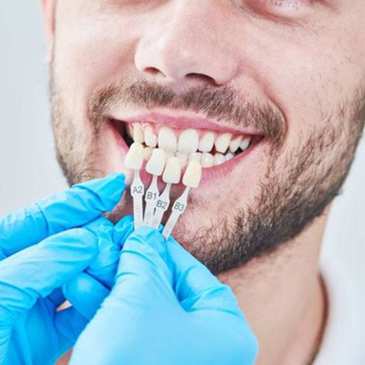 dentist holding several veneers up to a patient’s smile 