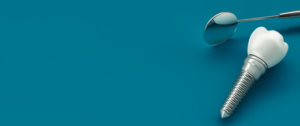 A dental implant next to a dental mirror