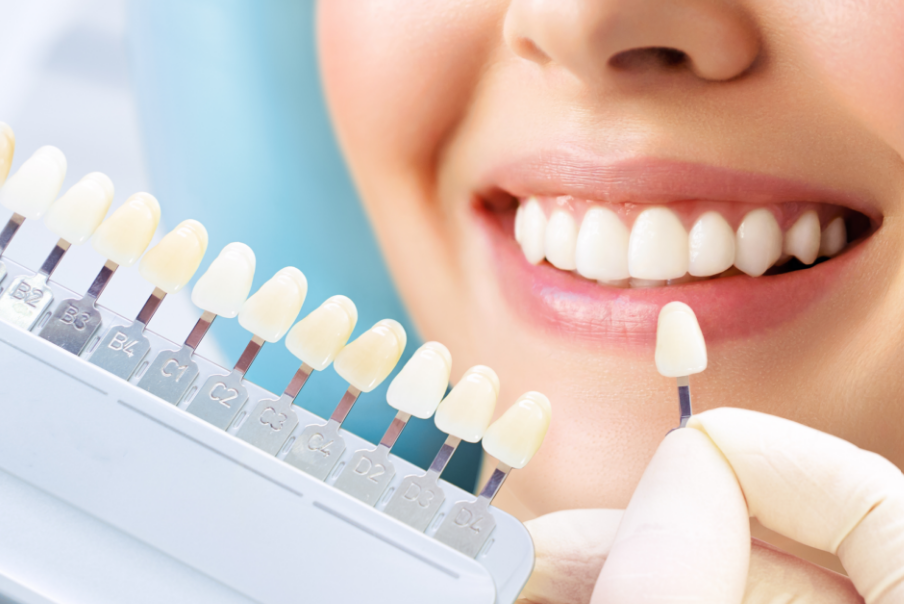 Close up of woman's smile and veneers